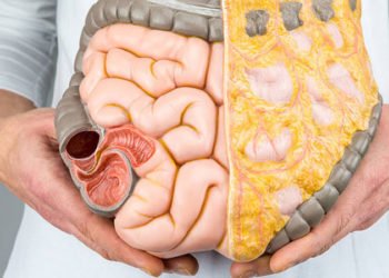 Rak želuca – simptomi, dijagnoza i liječenje