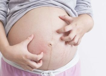Pojava tamne linije ispod pupka u trudnoći je sasvim uobičajena