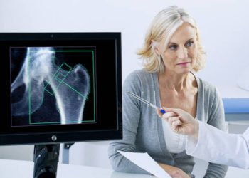 Osteoartritis – procjenjuje se da će do 2030. postati najveći uzročnik invaliditeta