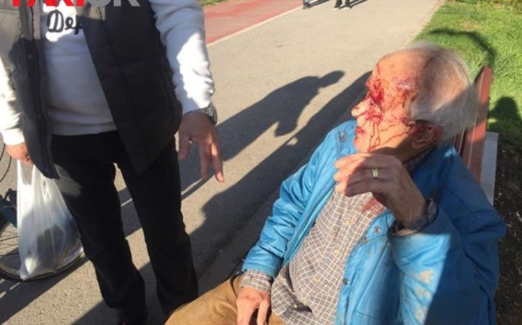 Užas u Sarajevu: Dvojica migranata brutalno pretukli i opljačkali starca