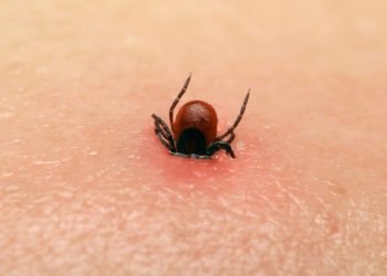 Budite oprezni: Počela je sezona krpelja, evo kako se zaštititi