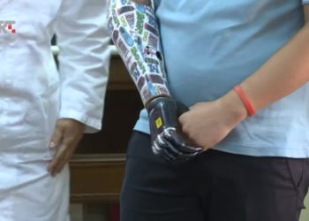 Ermin iz Jajca dobio mehaničku ruku kojom upravlja mislima