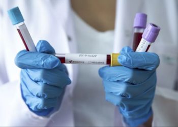 Upozorenje: Koronavirus možemo očekivati i u BiH