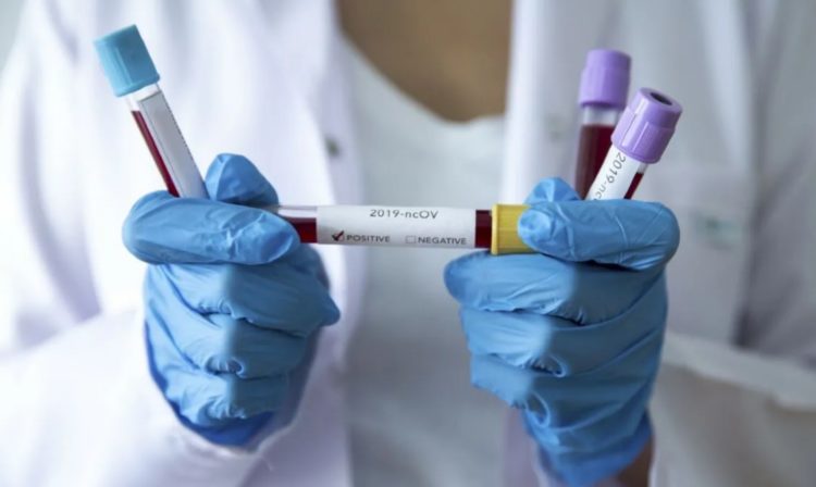 Upozorenje: Koronavirus možemo očekivati i u BiH