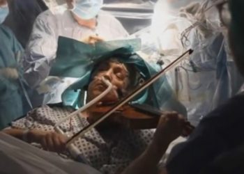 Pacijentica svirala violinu tijekom operacije mozga. Razlog je fascinantan