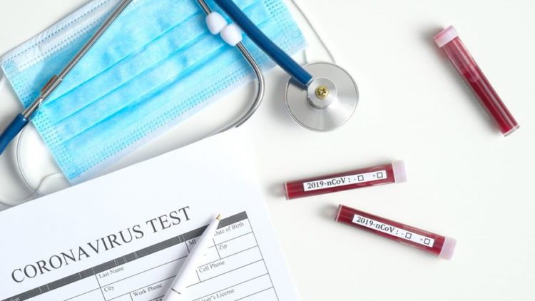 ŽZH: U samoizolaciji 295 osoba