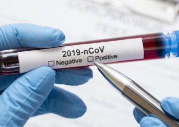 Zaraženi koronavirusom moraju biti mjesec u izolaciji i dva puta negativni na testu