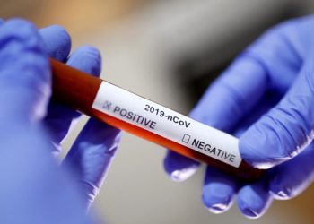 Novi slučajevi koronavirusa u ŽZH-u: Po dva iz Širokog Brijega i Gruda