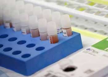 Od testiranih 28 uzoraka nema pozitivnih iz Hercegovačko-neretvanske županije