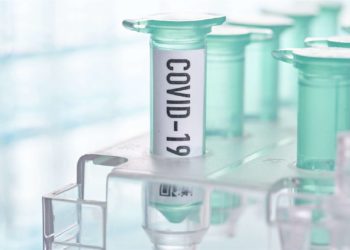 Broj zaraženih u BiH u padu, danas zabilježena 62 slučaja