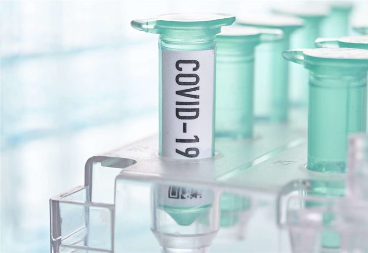 Broj zaraženih u BiH u padu, danas zabilježena 62 slučaja