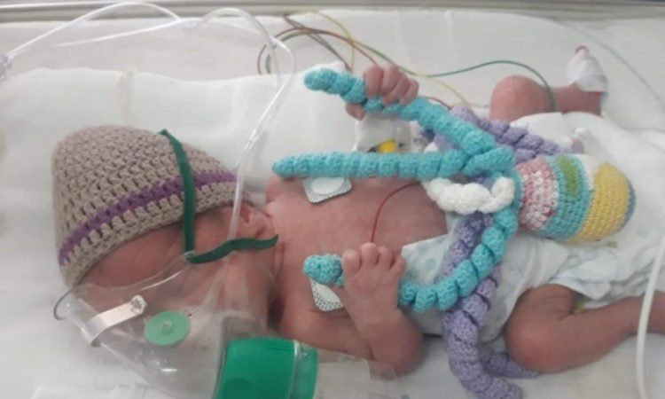 Pletene hobotnice za svako prijevremeno rođeno dijete u Mostaru