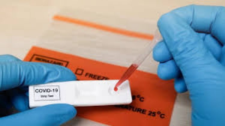 Njemačka: Uvodi se samotestiranje na koronu, 20 milijuna testova tjedno na raspolaganju