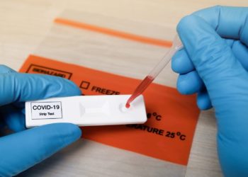 ZJZ ŽZH nudi usluge antigenskog i serološkog testiranja