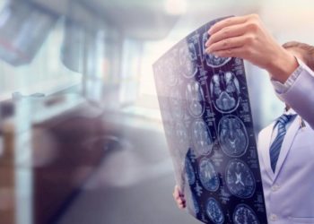 Neurološki problemi otkriveni kod svake treće osobe oporavljene od korone