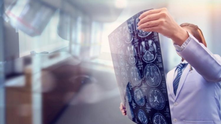 Neurološki problemi otkriveni kod svake treće osobe oporavljene od korone