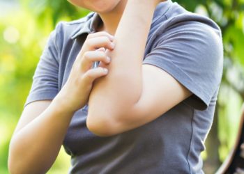 Ubod komarca: 7 pomagača koji odmah uklanjaju svrbež i crvenilo