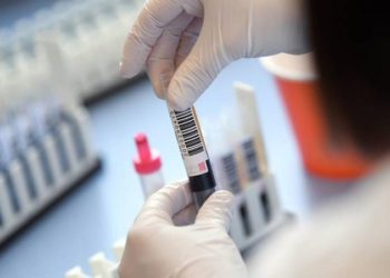 U Hercegovini otkriven gama soj koronavirusa