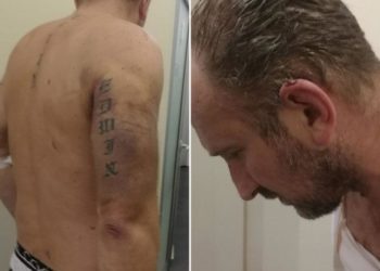 Sarajlija tvrdi: 12 ljudi me tuklo palicama i nogama u PU Široki Brijeg
