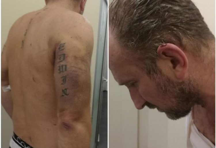 Sarajlija tvrdi: 12 ljudi me tuklo palicama i nogama u PU Široki Brijeg