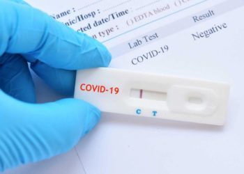 Koliko su pouzdani brzi antigenski testovi?