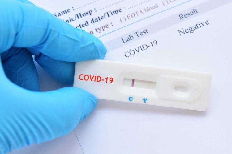 Koliko su pouzdani brzi antigenski testovi?