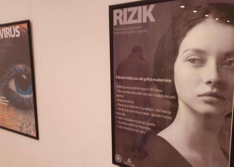 Rak grlića maternice može se otkriti samo redovnim i pravovremenim kontrolama