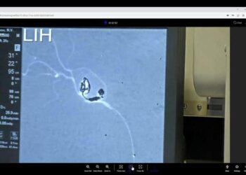 Operirali ga na daljinu: I hrvatski liječnik spašavao ukrajinskog vojnika kojem je šrapnel ušao u lubanju