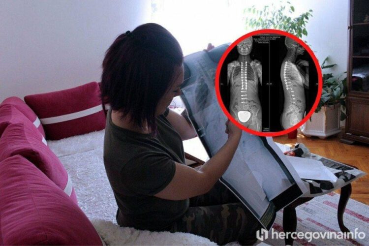 13-godišnja Iva Šunjić uspješno operirana u Turskoj! Majka zahvaljuje svima koji su pomogli