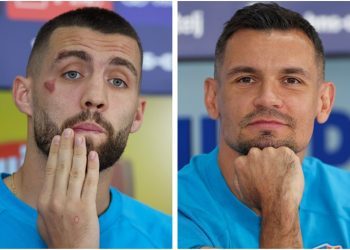 Kovačić pred novinare izašao s masnicama na glavi