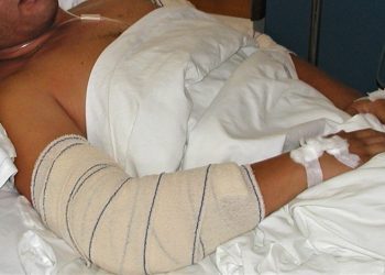 Žena i muškarac potukli se u stanu u 4 ujutro. On teško ozlijeđen, ona lakše