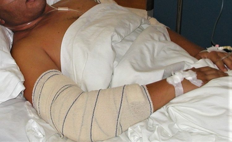 Žena i muškarac potukli se u stanu u 4 ujutro. On teško ozlijeđen, ona lakše