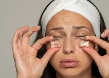 Kako oporaviti kožu nakon lude novogodišnje proslave besplatno