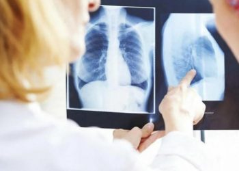 Stručnjaci upozoravaju: Raste broj oboljelih od karcinoma