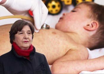 Epidemiologinja Obradović: Zbog dezinformacija roditelji ne cijepe djecu protiv morbila