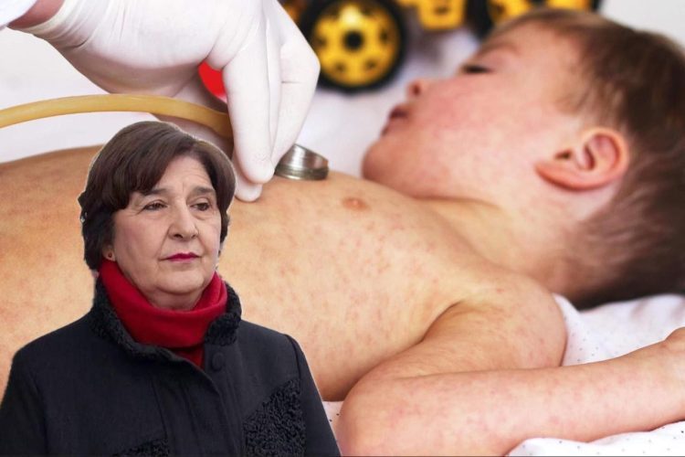 Epidemiologinja Obradović: Zbog dezinformacija roditelji ne cijepe djecu protiv morbila