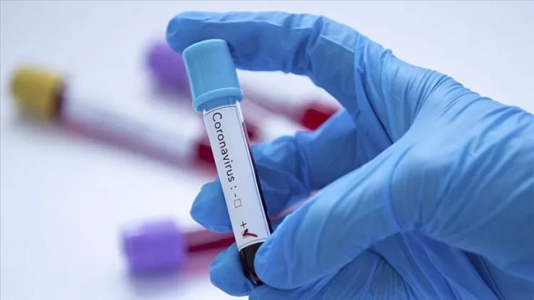 Sve je više dokaza da koronavirus ostavlja trajne posljedice na važnom sustavu u tijelu