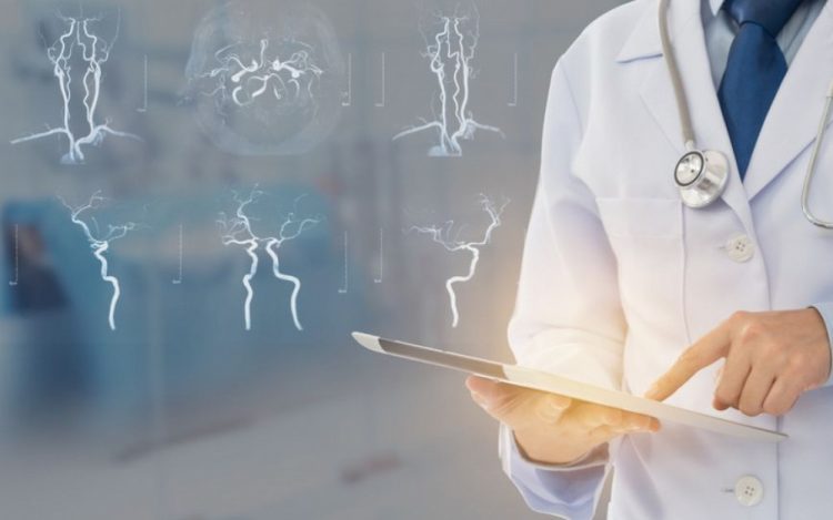 Sve je više moždanih udara među mlađim odraslim osobama