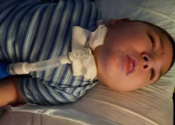 Obitelj malenog Marija Ujdura koji ima 22 dijagnoze treba pomoć