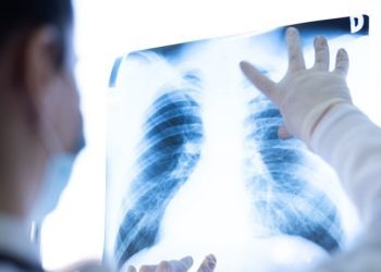 Prvi put u sedam zemalja kreće ispitivanje cjepiva protiv najsmrtonosnijeg raka