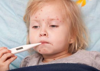 Enomrno narastao broj zaraženih ospicama