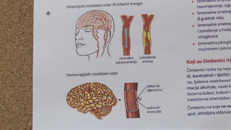 Ljubuški: Obilježen Svjetski dan moždanog udara