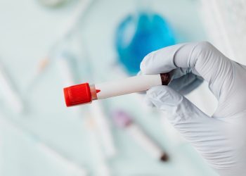 Jesu li povišeni tumorski markeri siguran znak raka?