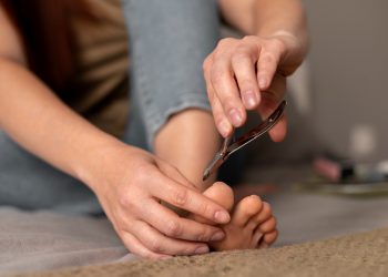 Evo zašto nokti na nogama žute