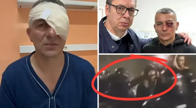 Srbija: Istina isplivala na vidjelo: Policajac priznao da ga je udario kolega: “To je od lijekova”