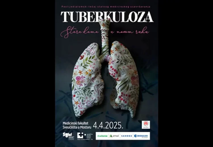 Simpozij o tuberkulozi: “Stara dama u novom ruhu”
