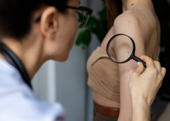 SKB Mostar – Obilježavanje „Euromelanoma 2025“ u Klinici za kožne i spolne bolesti