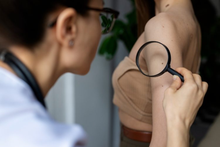 SKB Mostar – Obilježavanje „Euromelanoma 2025“ u Klinici za kožne i spolne bolesti