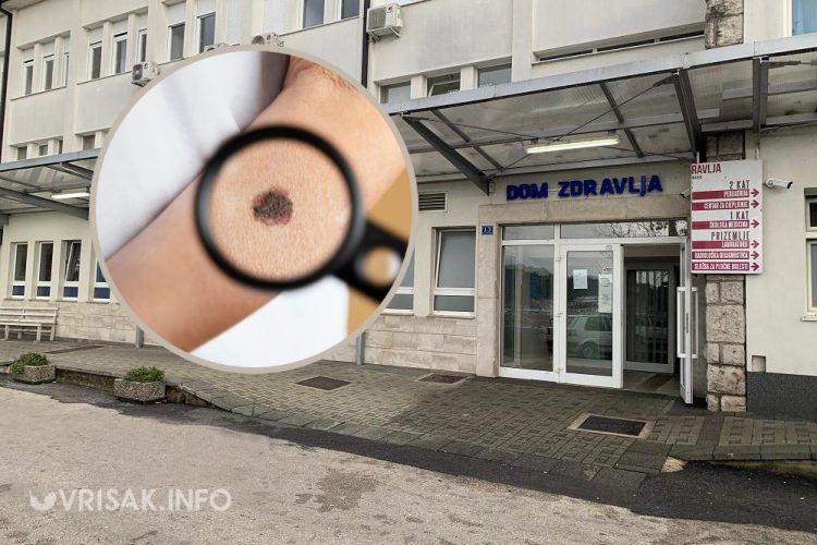 Dom zdravlja Široki Brijeg organizira besplatne preglede kože