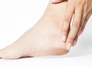 Tajna mekih peta: Čudesni recept s jednim kuhinjskim sastojkom